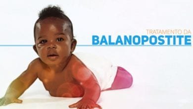 Tratamento da Balanopostite - nova