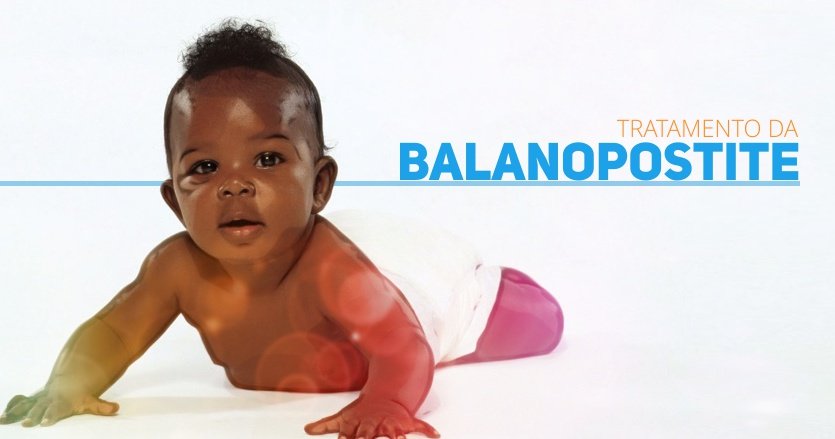 Tratamento da Balanopostite - nova