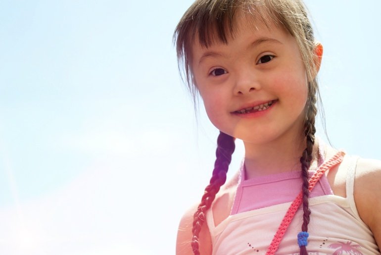 Síndrome de Down - o que o pediatra deve saber | PortalPed
