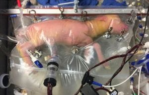 utero artificial