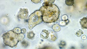 clevers organoide colon