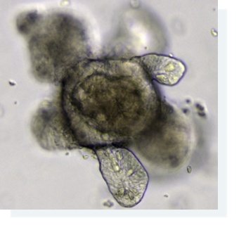 organoide intestino - mini orgaos