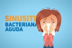 sinusite bacteriana aguda em pediatria