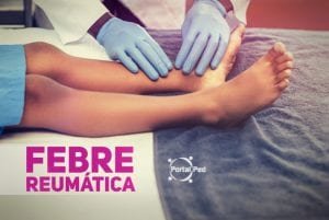 febre reumatica sintomas e atualizacoes pediatria social