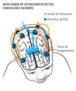 sonda de ultrassom criancas