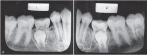 Odontopediatria para crianças e adolescentes de Mc Donald R & Avery