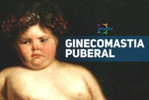 ginecomastia puberal - pediatria - social