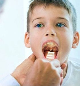 medico examinando garganta crianca