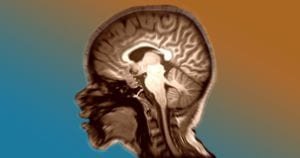 escaneamento cerebral