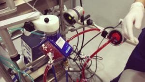 exemplo de circuito de ECMO montado (1)