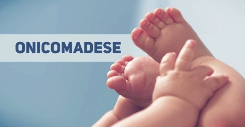 Onicomadese Pediatria