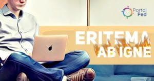 eritema ab igne - o que e como tratar - social