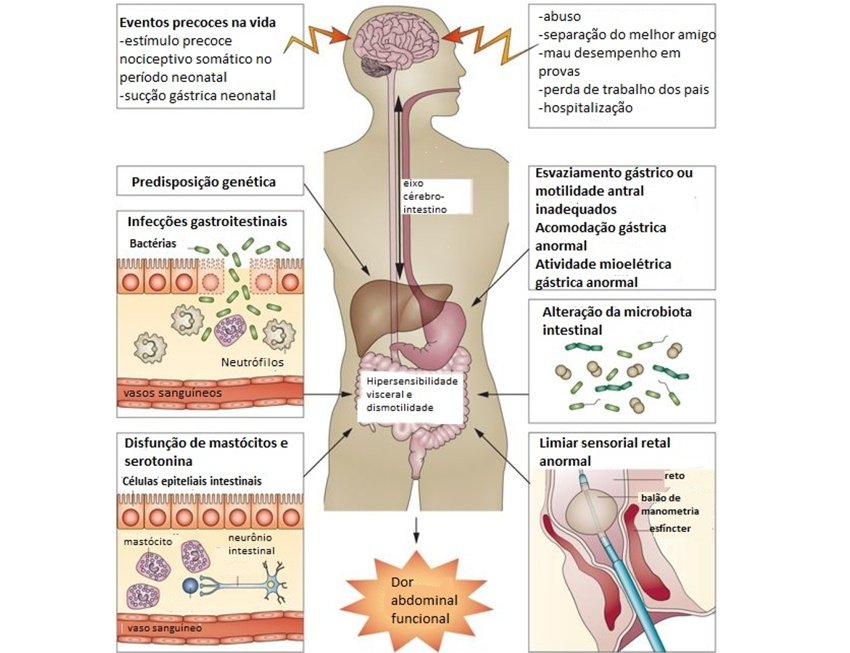 Patogenese da dor abdominal funcional