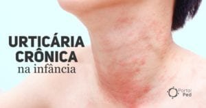 urticaria cronica na infancia - social