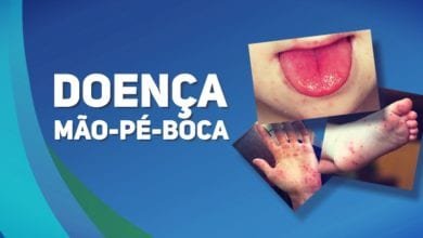 Doenca Mao-Pe-Boca Pediatria