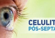 celulite orbitaria pos-septal - tratamentos pediatria