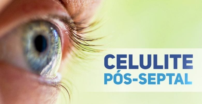 celulite orbitaria pos-septal - tratamentos pediatria