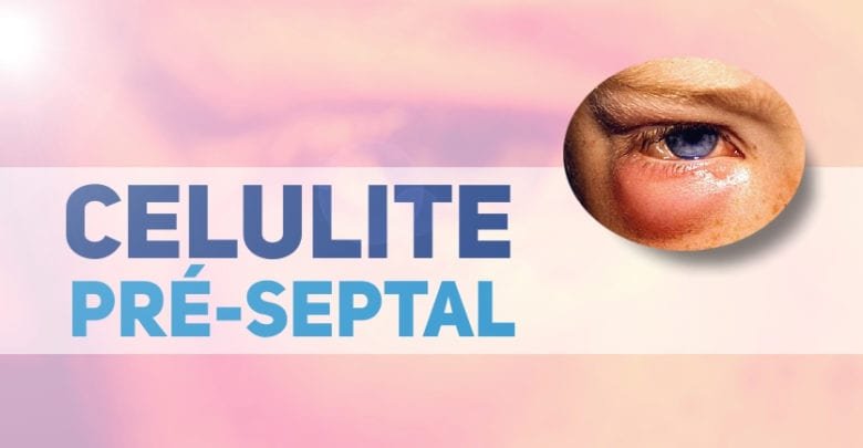 celulite pre-septal - tratamentos pediatria(1)