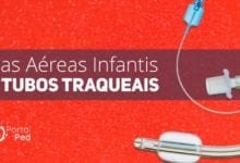 formato via aerea pediatrica e tubo traqueal com cuff D