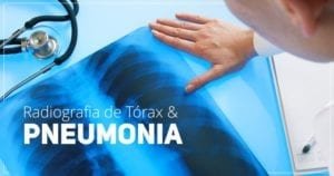 Radiografia de Torax e Diagnostico de Pneumonias