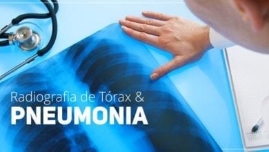 Radiografia de Torax e Diagnostico de Pneumonias