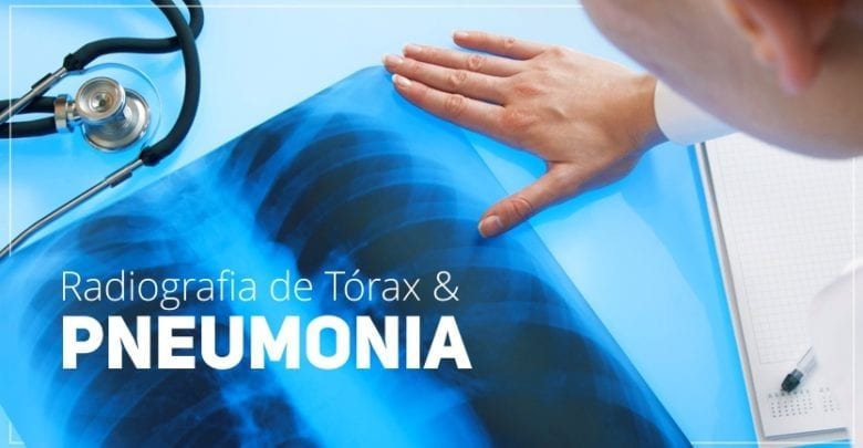 Radiografia de Torax e Diagnostico de Pneumonias