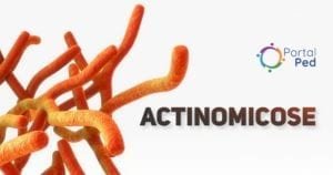 Actinomicose - pediatria - social