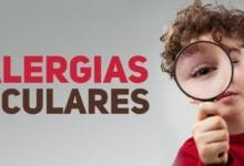 Alergias oculares - pediatria