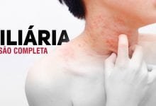 Miliaria - revisao pediatria PortalPed