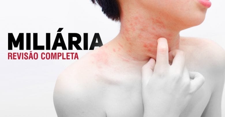 Miliaria - revisao pediatria PortalPed